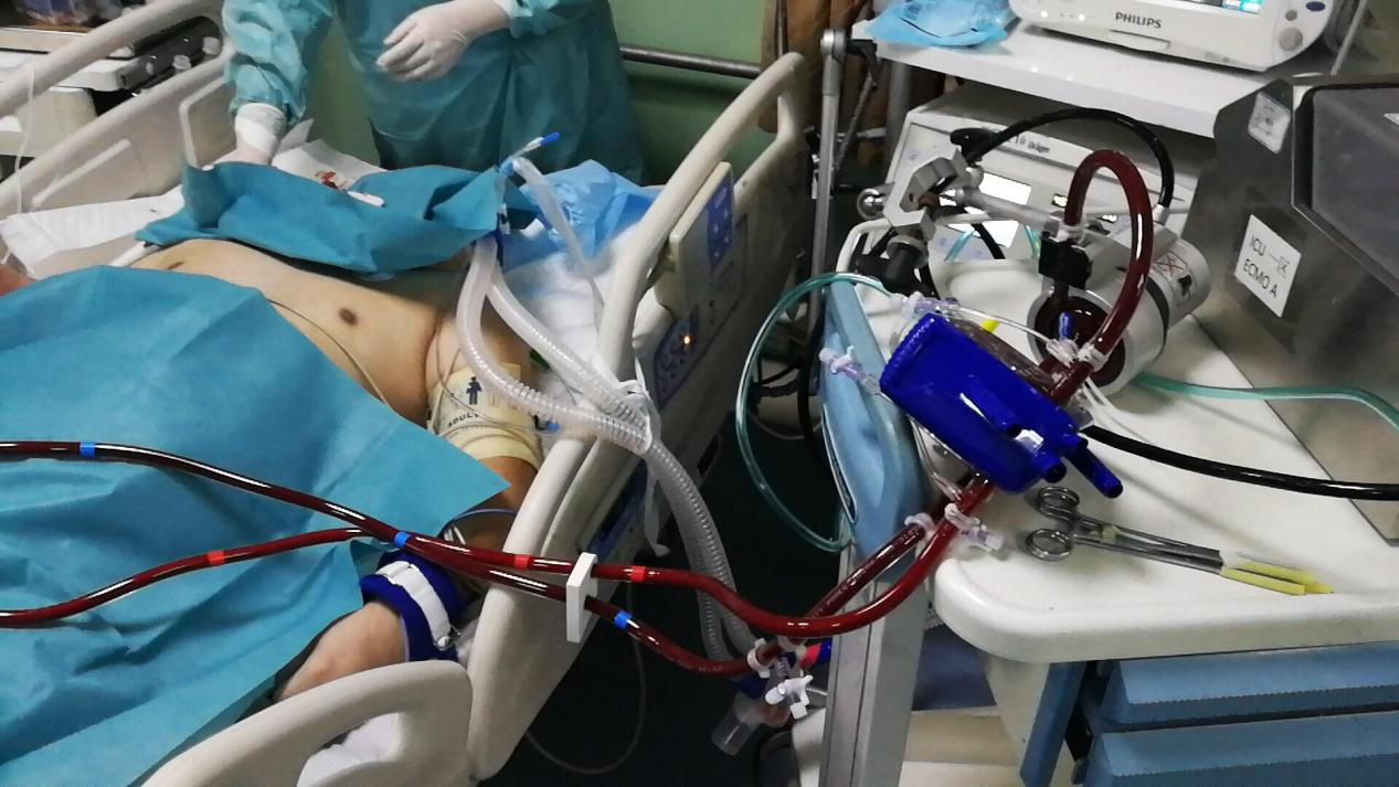 ECMO,医疗保险